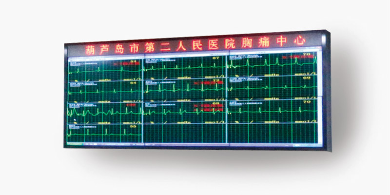 实时动态监测